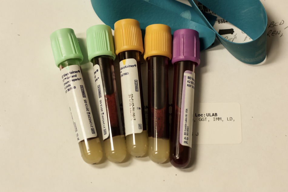 blood-test-1.jpg