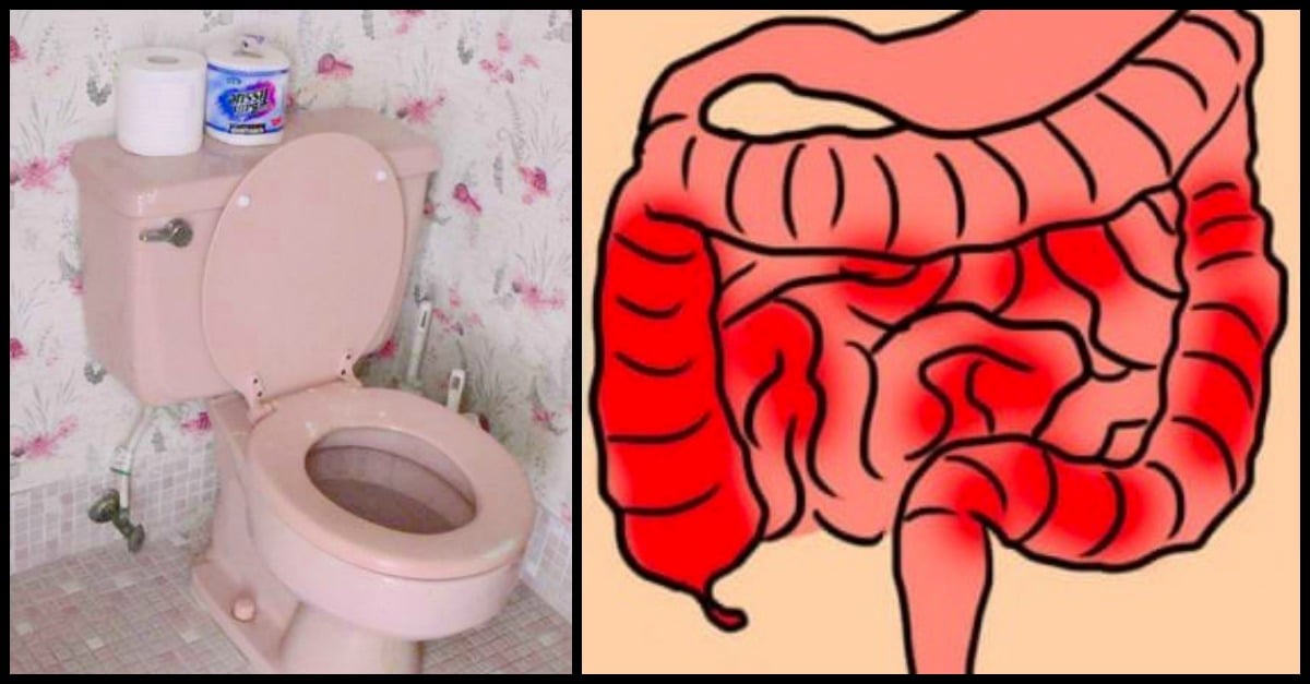What Causes Blood In Stools? 10 Possible Health Conditions