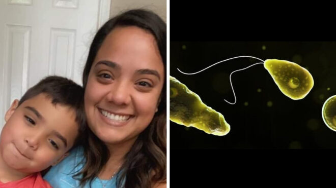 brain-eating-amoeba