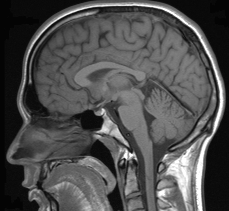 brain-scan-1.jpg