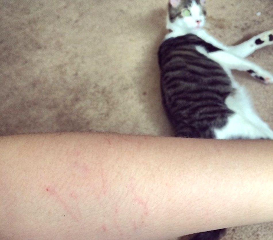 cat-scratches.jpg