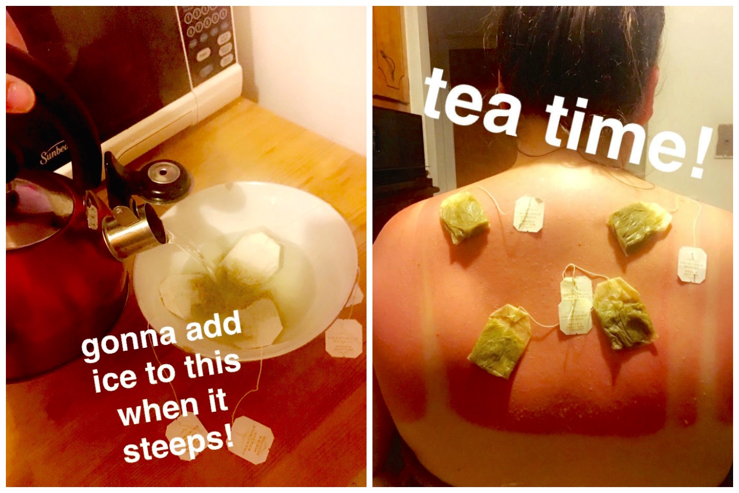 chamomile-tea-sunburn.jpg