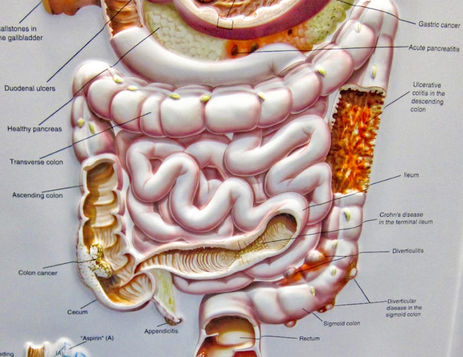 colonoscopy-30-minutes1.jpg