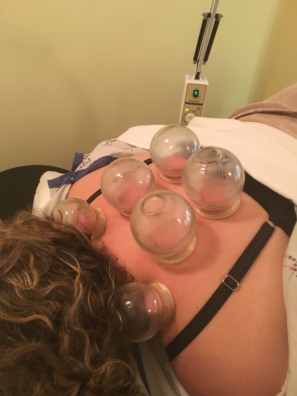 cupping.jpg