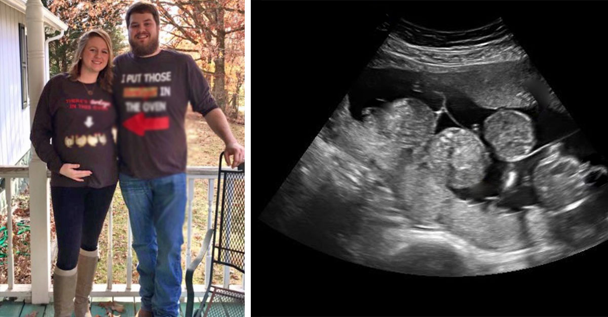 davidson quadruplets ultrasound