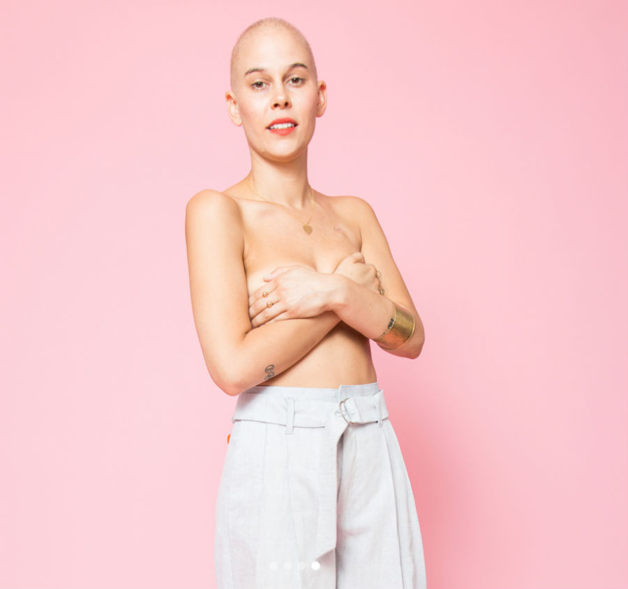 double-mastectomy-2.jpg