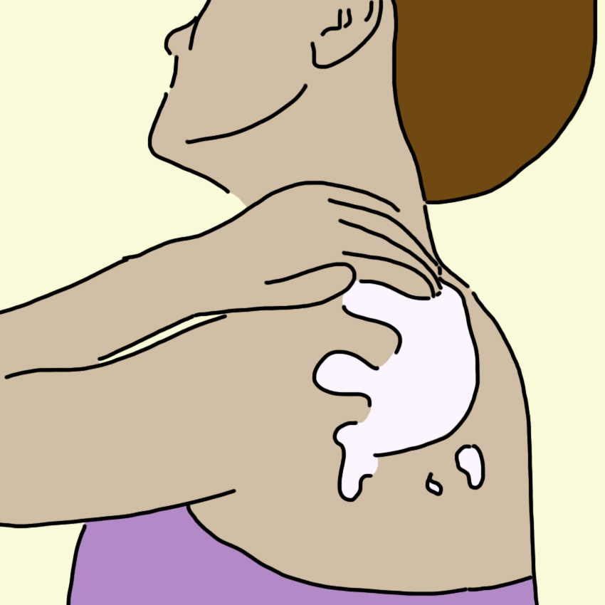 eczemaremedies_850px_5.jpg