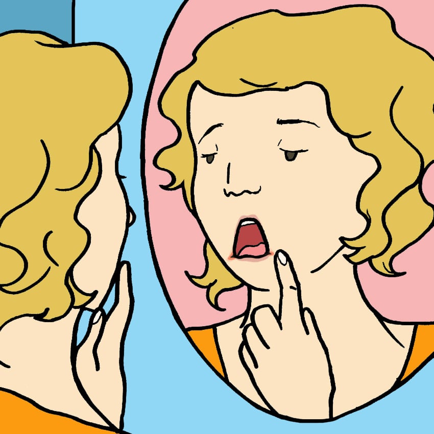 embeddedIMG_7Non-VaginalYeastInfections_850px_3.jpg