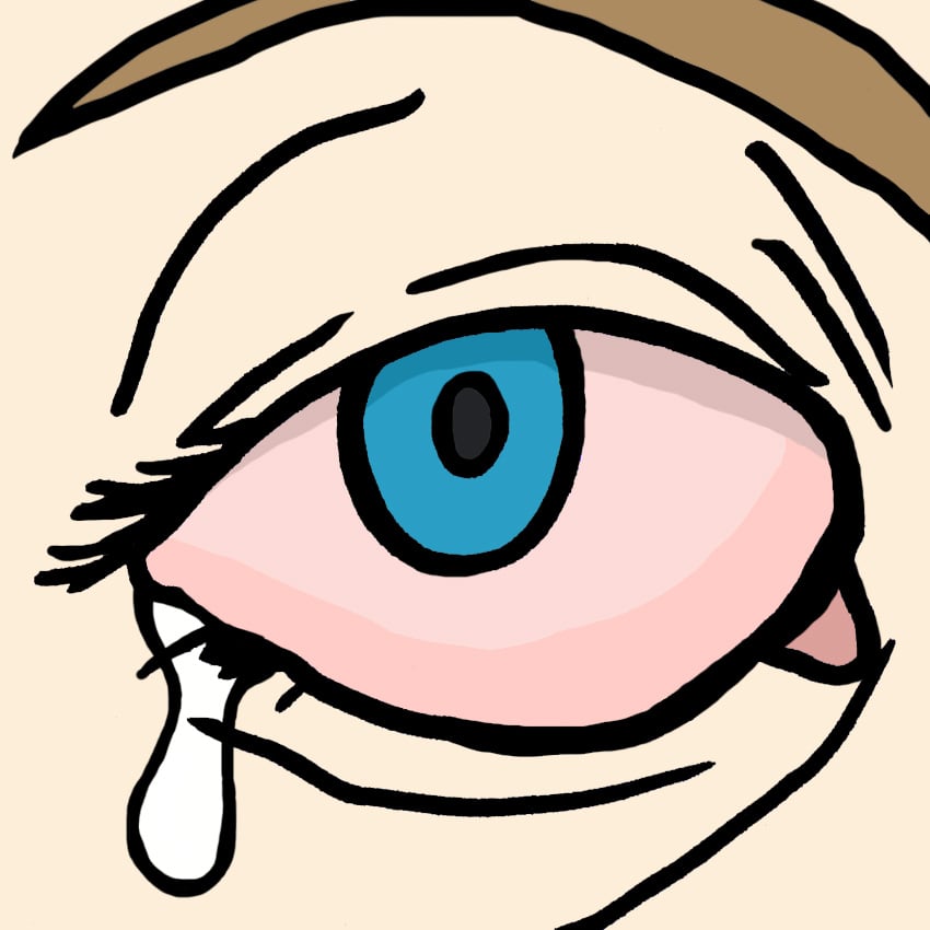 embeddedIMG_All-NaturalRemediesForPinkeye_850px_3.jpg