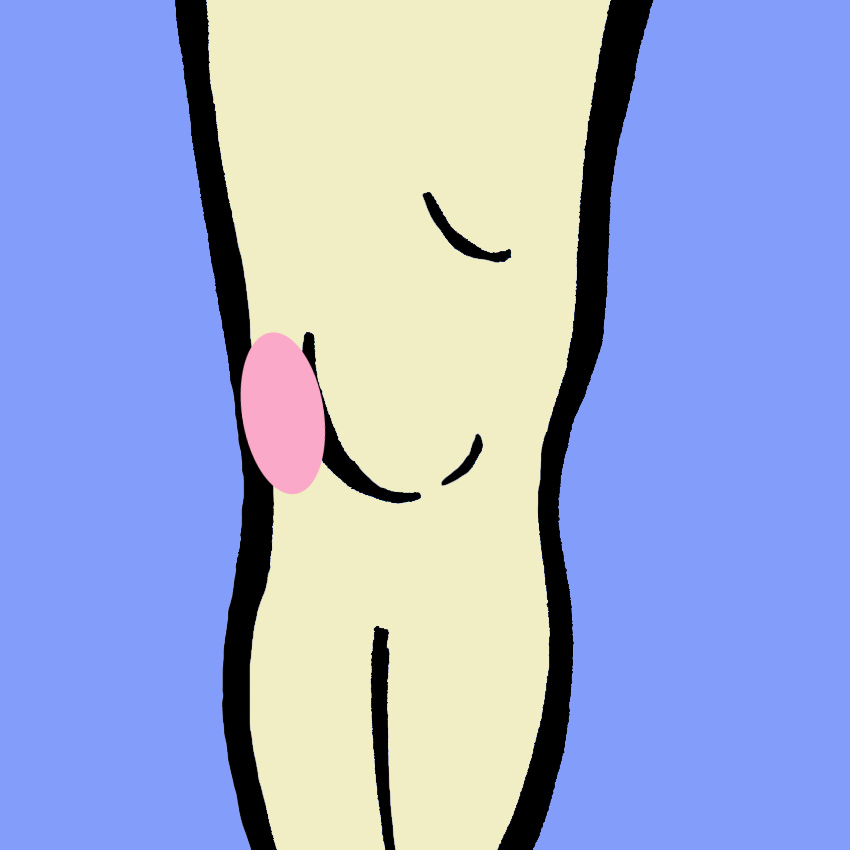 embeddedIMG_KneePain-WhatItMeansAndHowToFightIt_850px_2.jpg
