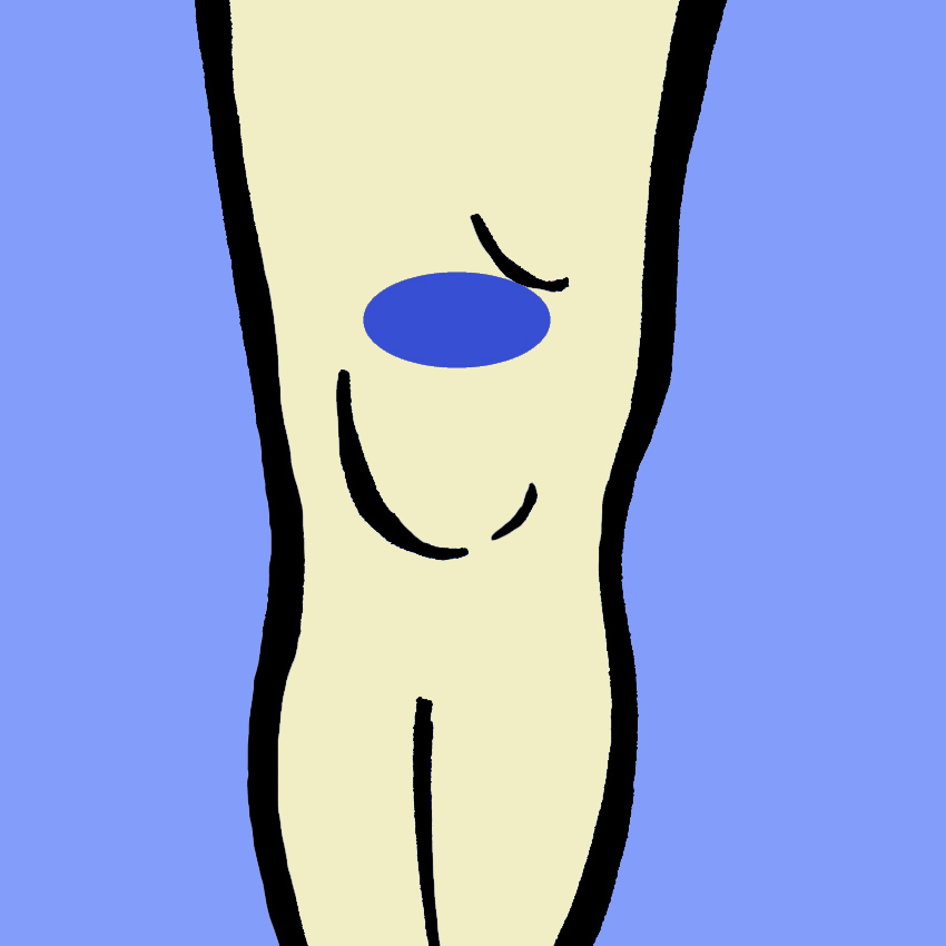 embeddedIMG_KneePain-WhatItMeansAndHowToFightIt_850px_3.jpg