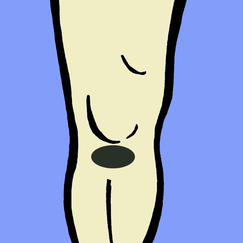 embeddedIMG_KneePain-WhatItMeansAndHowToFightIt_850px_4.jpg