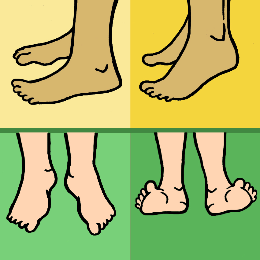 embeddedIMG_ManagingBunionsAtHomeForHealthyComfyFeet_850px_3.jpg