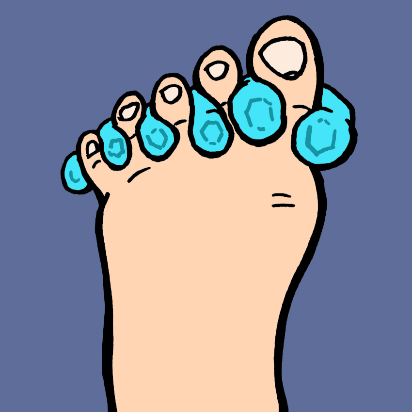 embeddedIMG_ManagingBunionsAtHomeForHealthyComfyFeet_850px_7.jpg