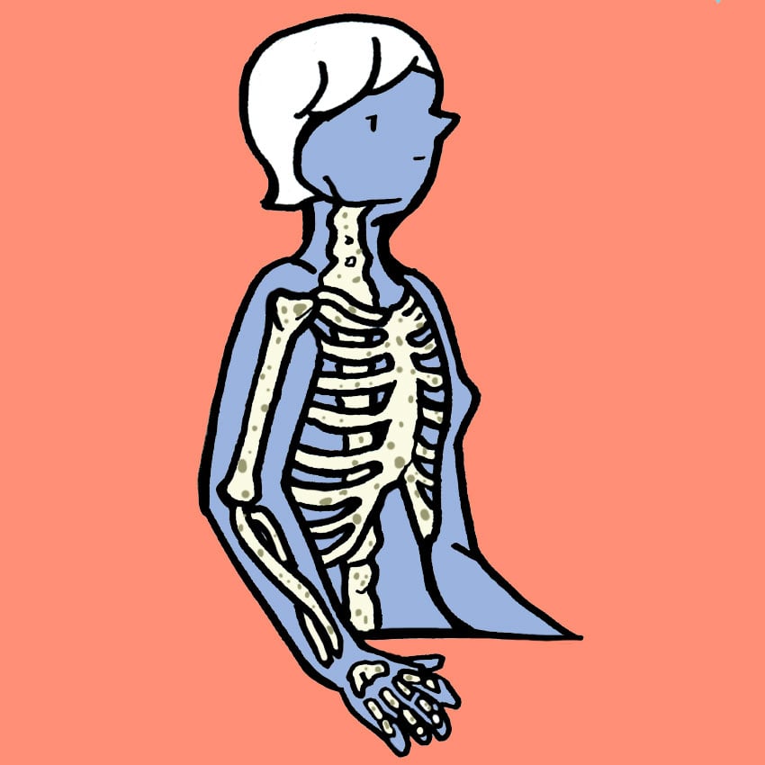 embeddedIMG_OsteoporosisMythsandRemedies_850px_1.jpg