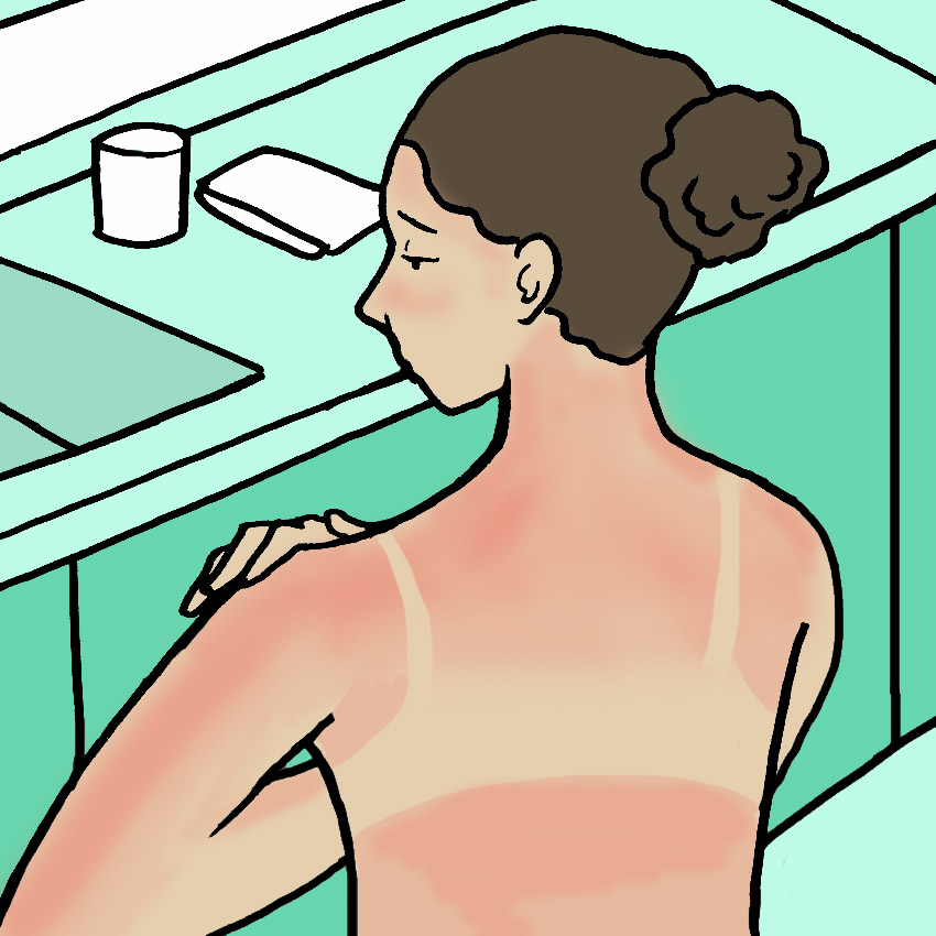 embeddedIMG_ThingsYouShouldNeverDoToASunburn_850px_1.jpg embeddedIMG_ThingsYouShouldNeverDoToASunburn_850px_1.jpg
