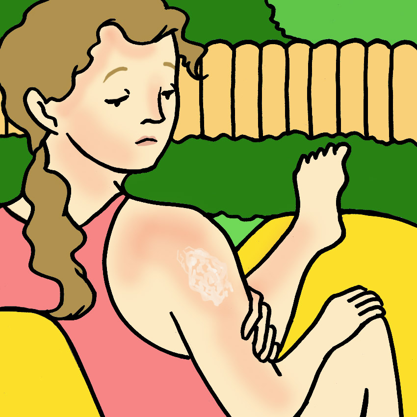 embeddedIMG_ThingsYouShouldNeverDoToASunburn_850px_5.jpg embeddedIMG_ThingsYouShouldNeverDoToASunburn_850px_5.jpg