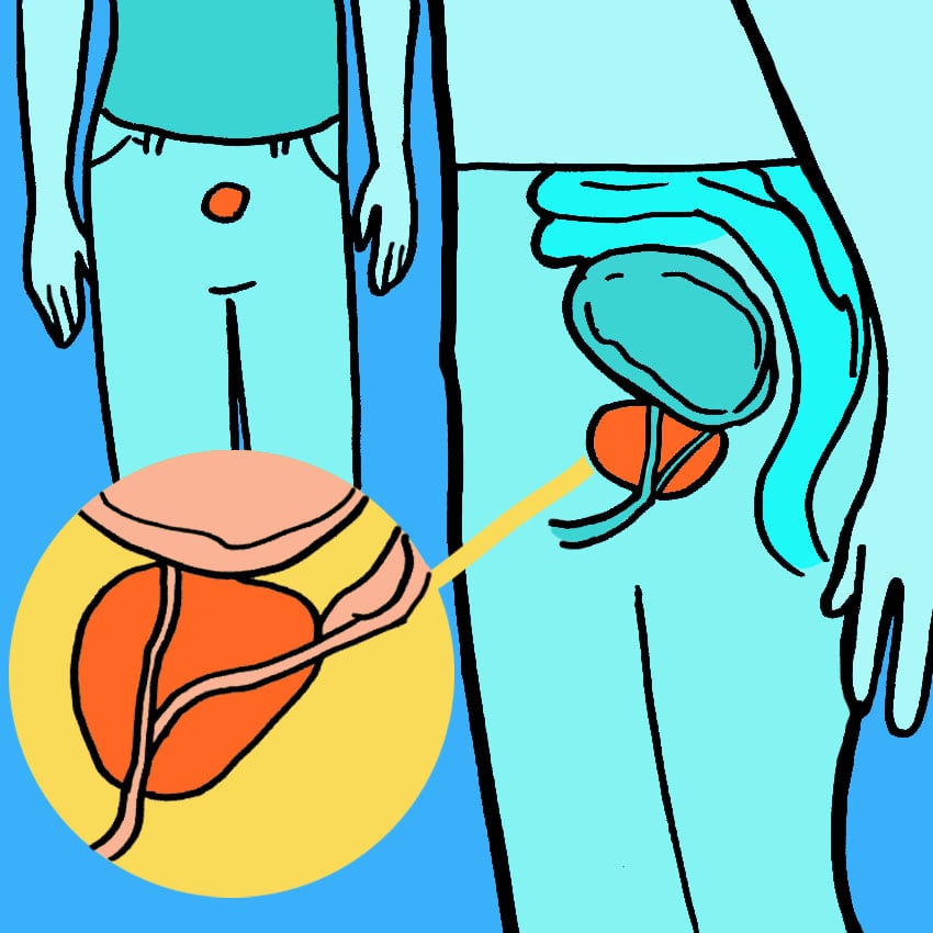 embeddedIMG_WarningSignsMenShouldNeverIgnoreFromTheirProstate_850px_1.jpg