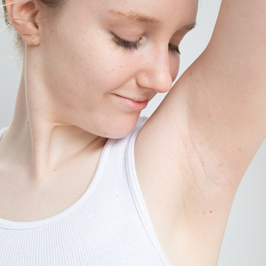 embeddedIMG_armPitClean_850px_9.jpg