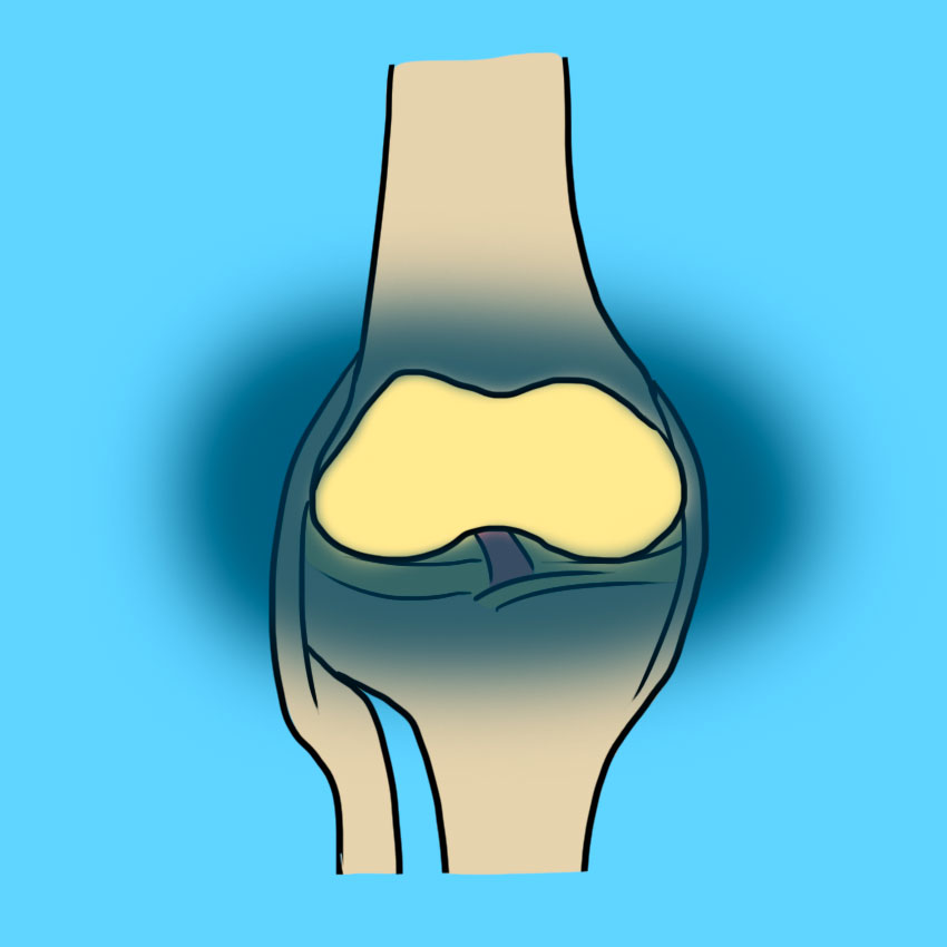 embeddedIMG_cartilage_850px_1.jpg