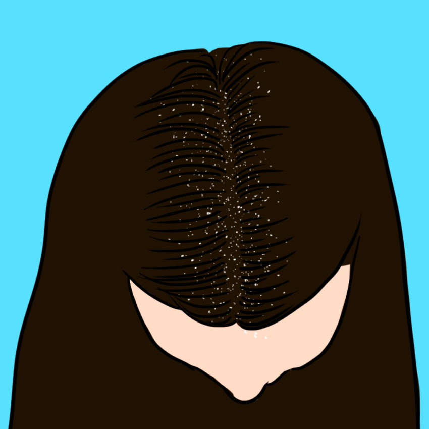 embeddedIMG_howtopreventandslowfemalehairloss_850px_6.jpg