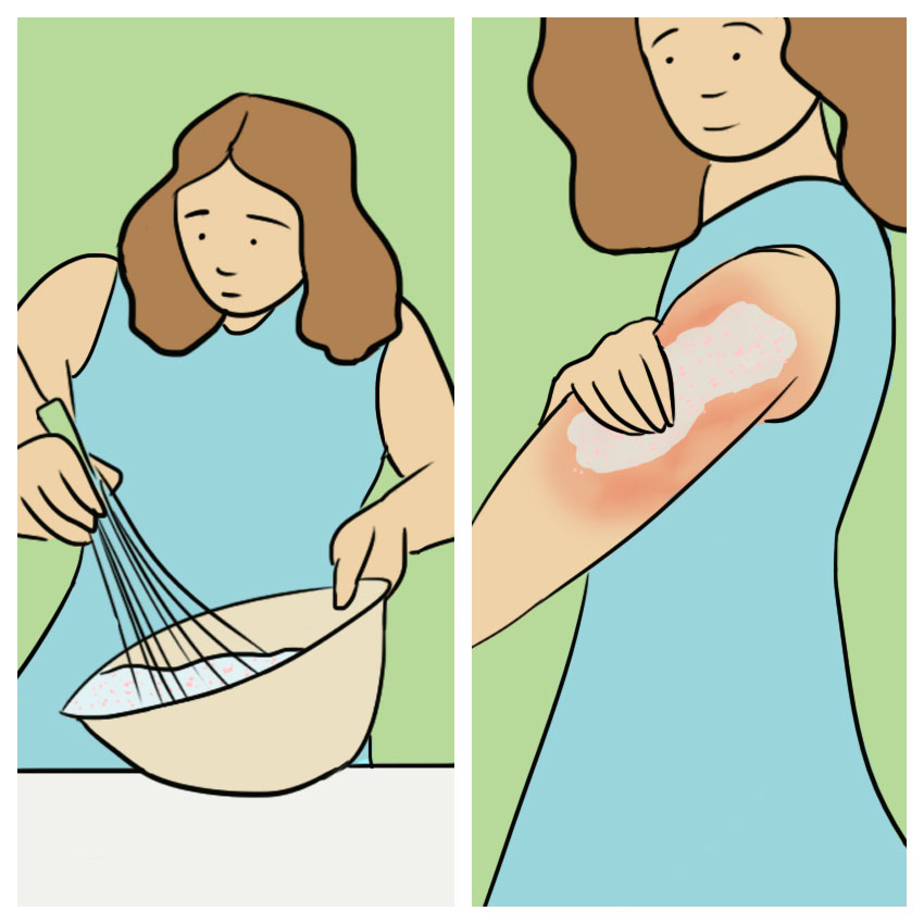 embeddedIMG_identifyingposionivyoaktreatments_850px_10.jpg