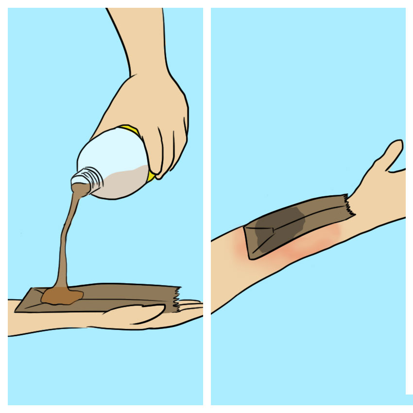 embeddedIMG_identifyingposionivyoaktreatments_850px_7.jpg