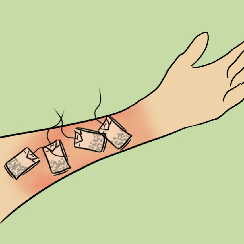 embeddedIMG_identifyingposionivyoaktreatments_850px_8.jpg