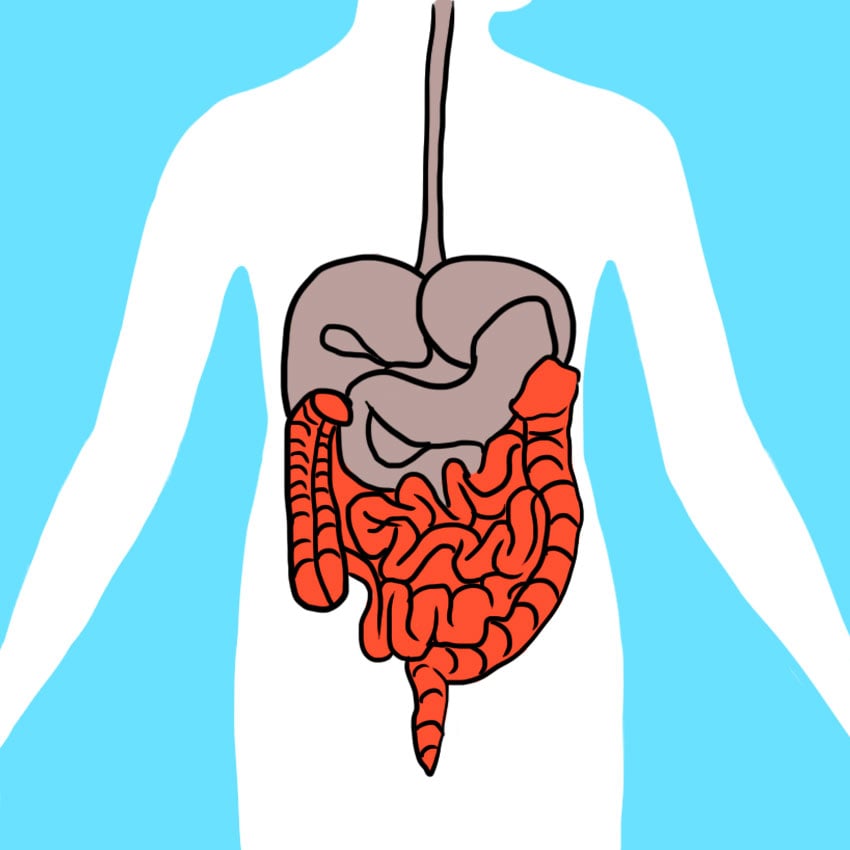 embeddedIMG_leakygut_850px_1.jpg embeddedIMG_leakygut_850px_1.jpg