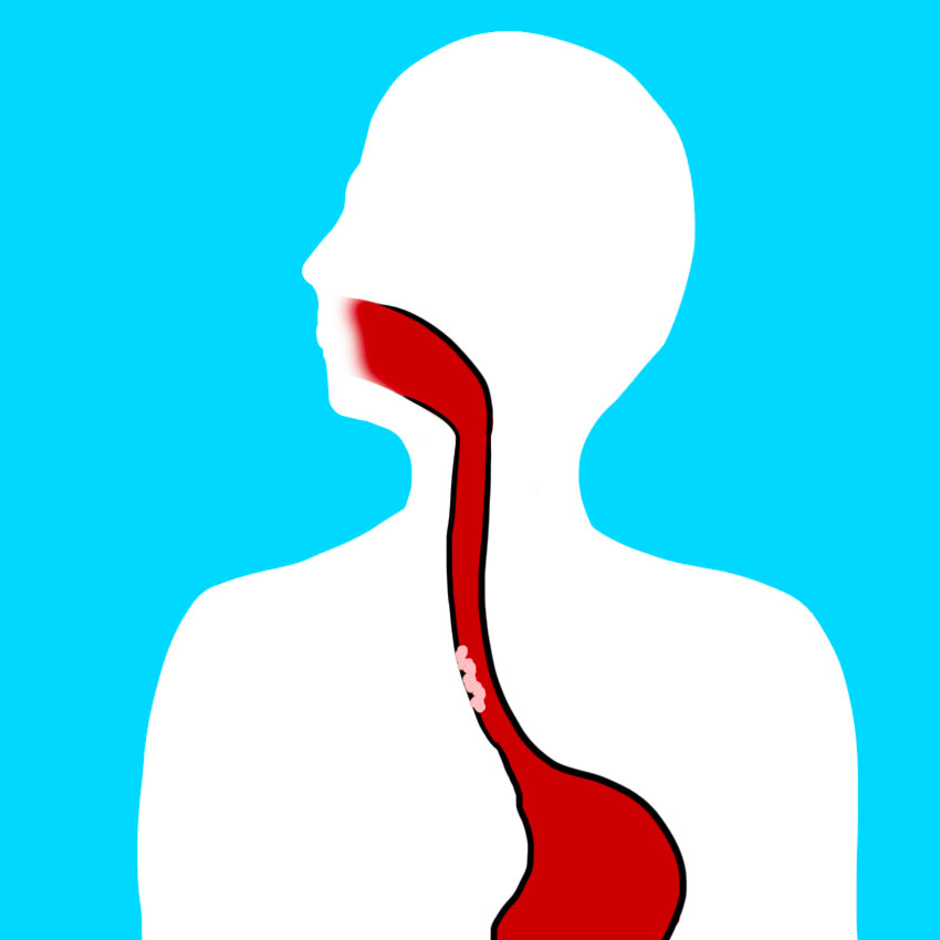 embeddedIMG_reasonsforbloodinyourstool_850px_3_-1.jpg embeddedIMG_reasonsforbloodinyourstool_850px_3_-1.jpg