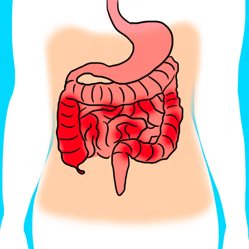 embeddedIMG_reasonsforbloodinyourstool_850px_6_-2.jpg embeddedIMG_reasonsforbloodinyourstool_850px_6_-2.jpg