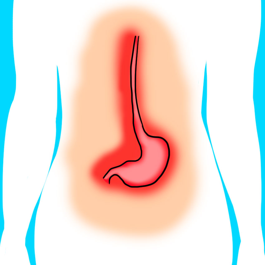 embeddedIMG_reasonsforbloodinyourstool_850px_9_-1.jpg embeddedIMG_reasonsforbloodinyourstool_850px_9_-1.jpg
