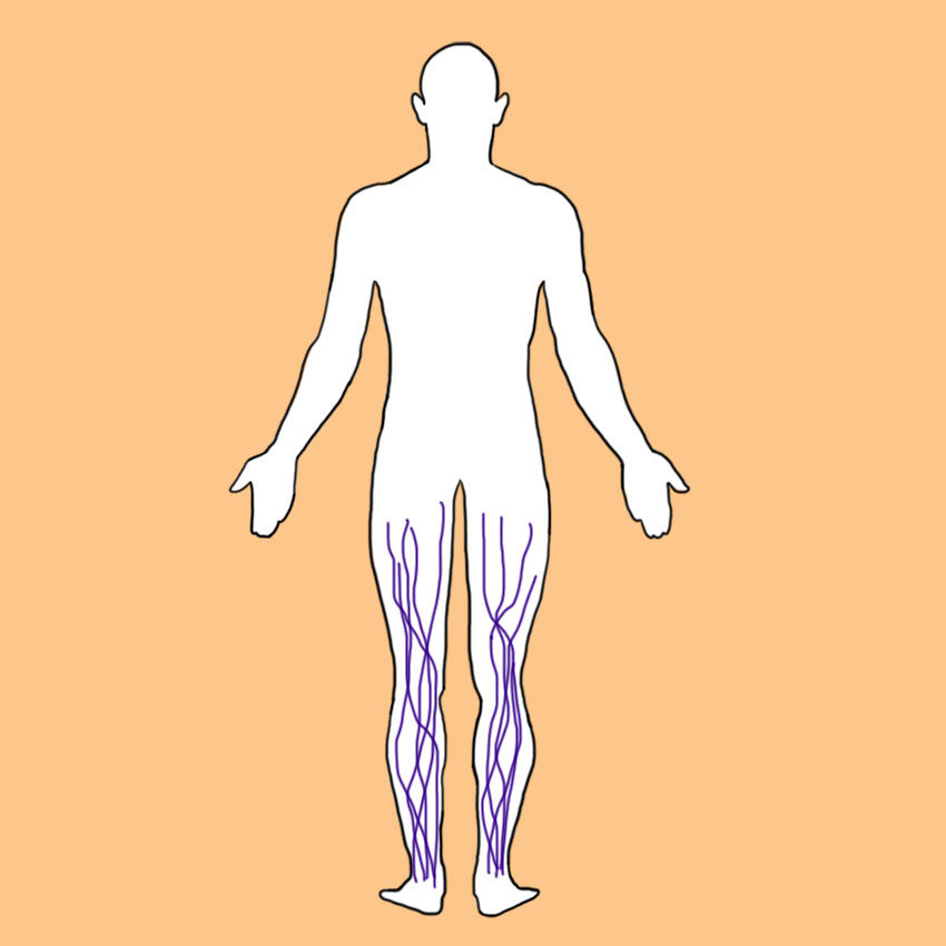 embeddedIMG_symptomsofdvt_850px_1.jpg