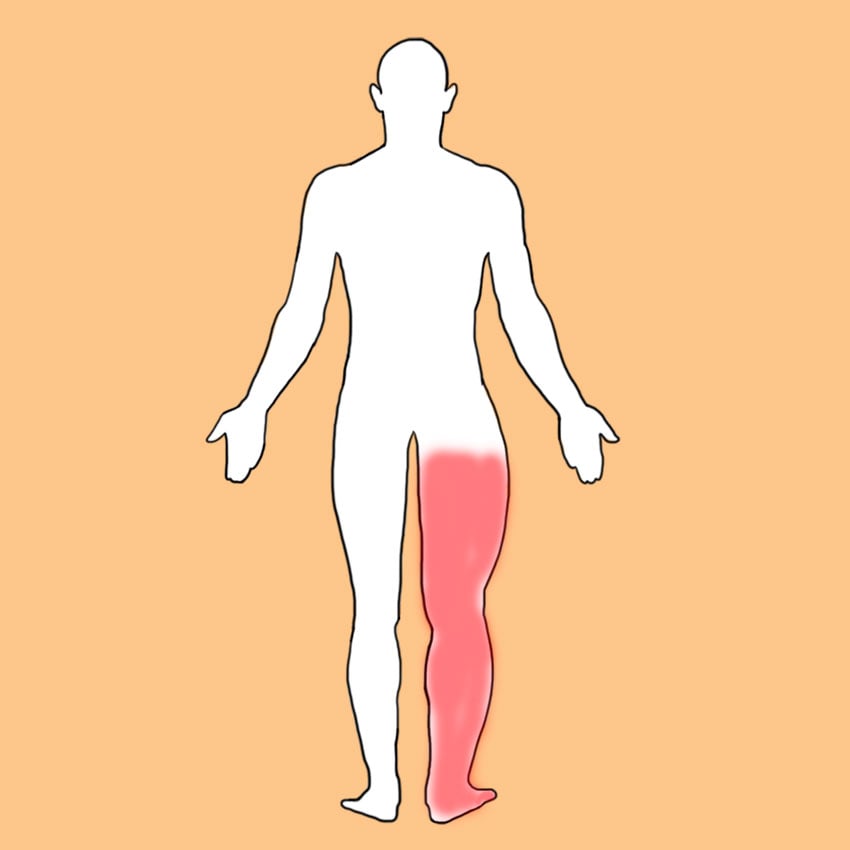embeddedIMG_symptomsofdvt_850px_3.jpg