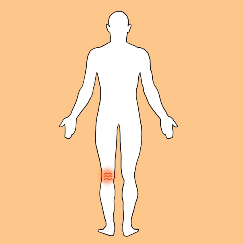 embeddedIMG_symptomsofdvt_850px_4.jpg