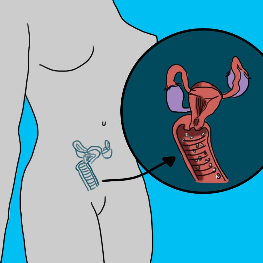 embeddedIMG_yeastinfectionremedies_850px_1.jpg