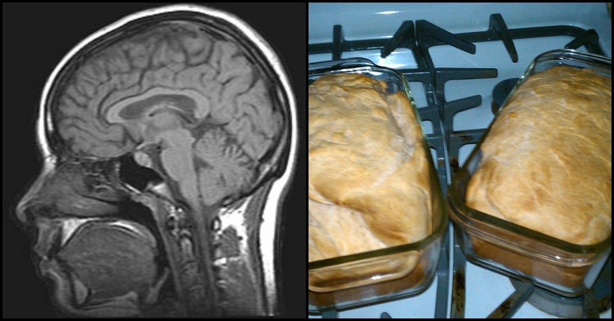 food-prevent-alzheimers.jpg food-prevent-alzheimers.jpg