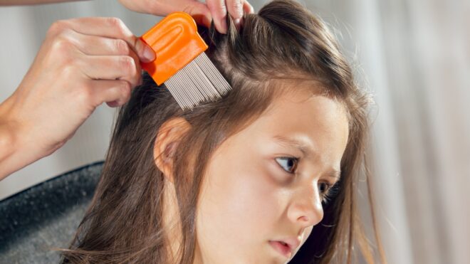 head-lice