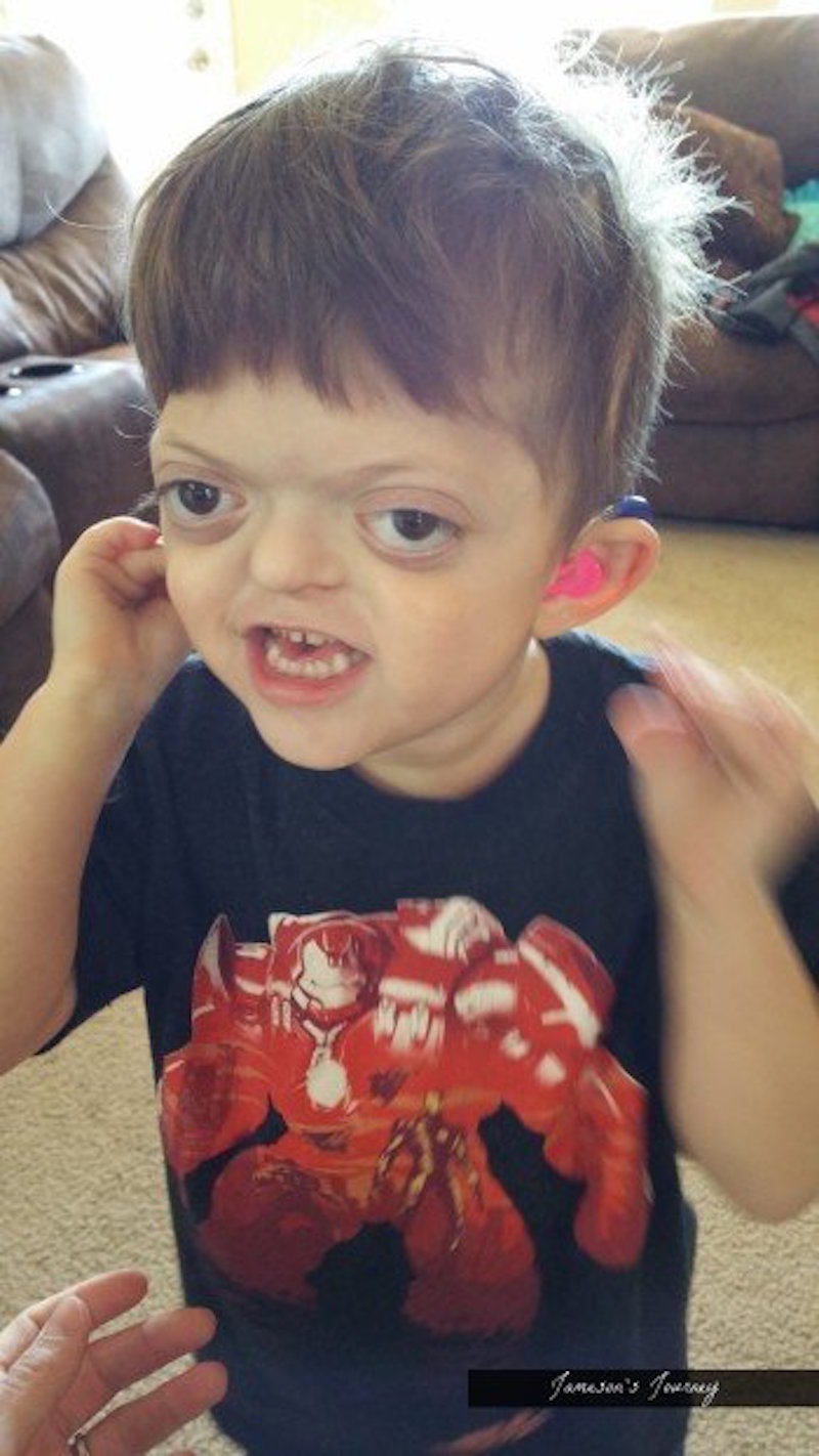 hearing-aid-1-e1454263849737.jpg