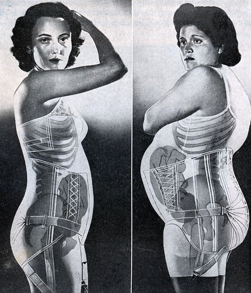 maternity-girdle.jpg