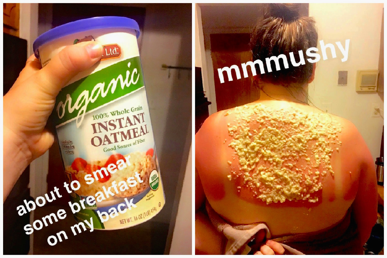 oatmeal-sunburn.jpg