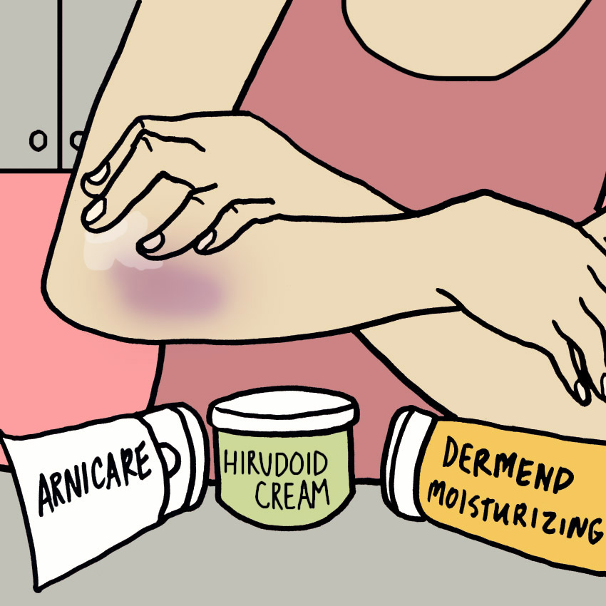 over-the-counter-bruise-ointments.jpg