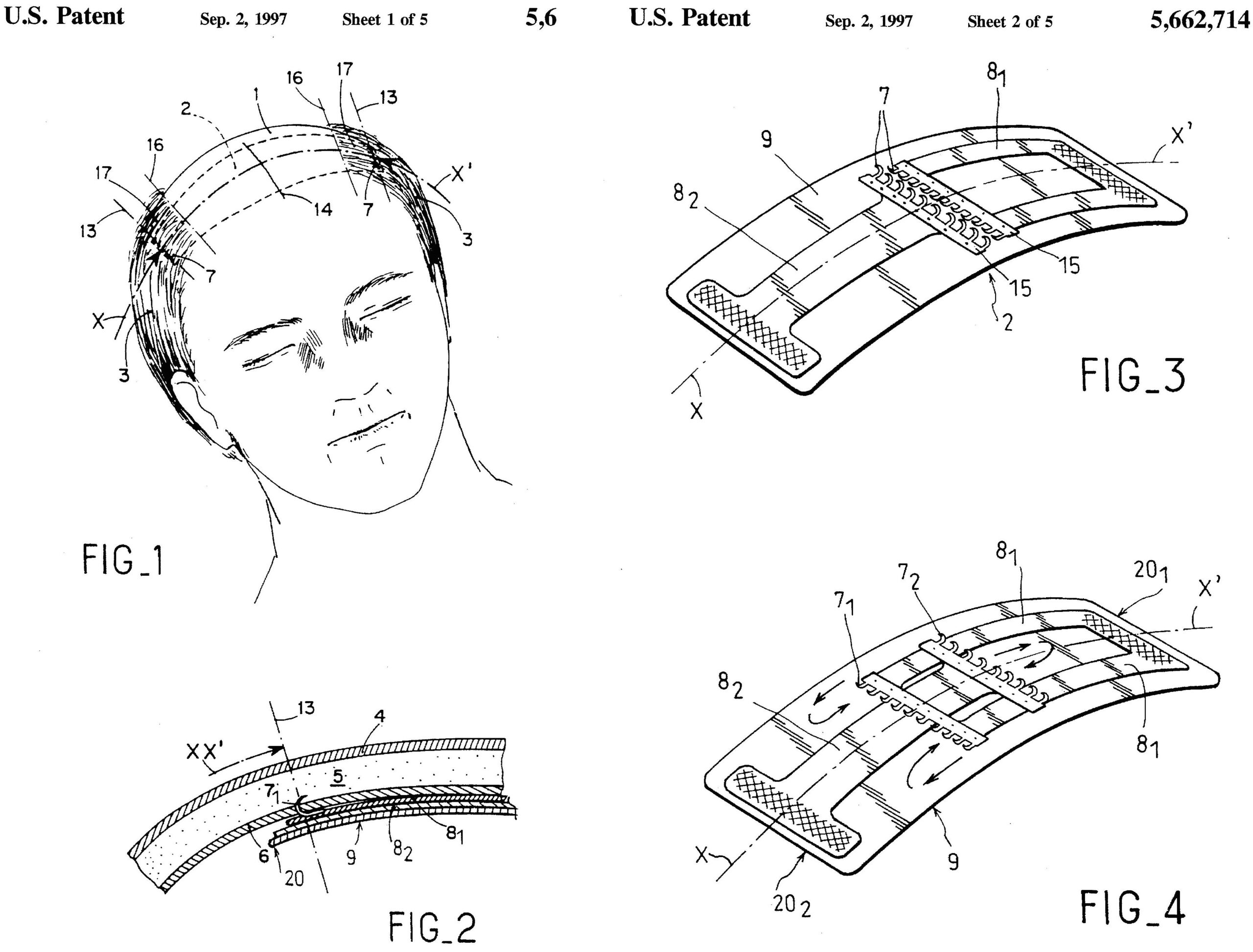 patent-1313.jpg