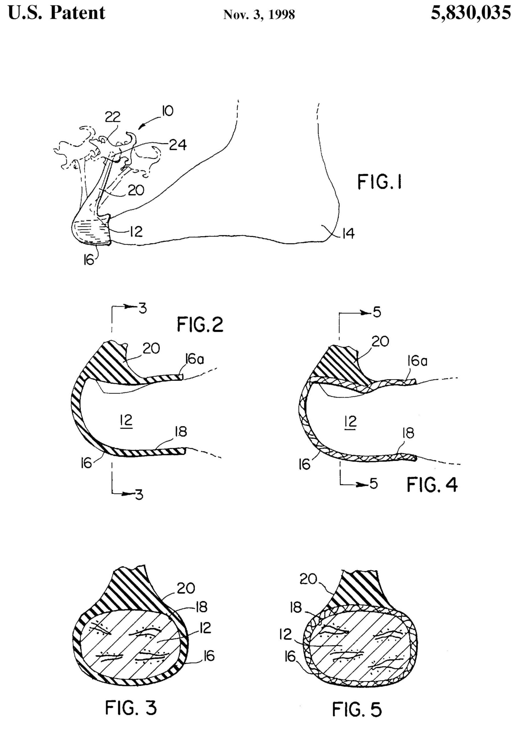 patent-1414.jpg