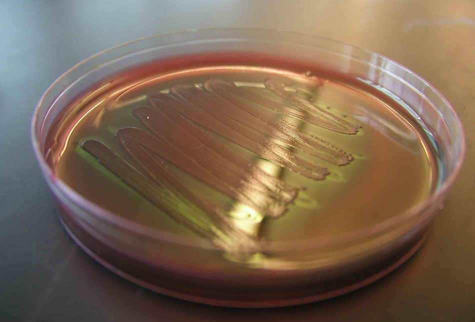 petri-dish.jpg petri-dish.jpg