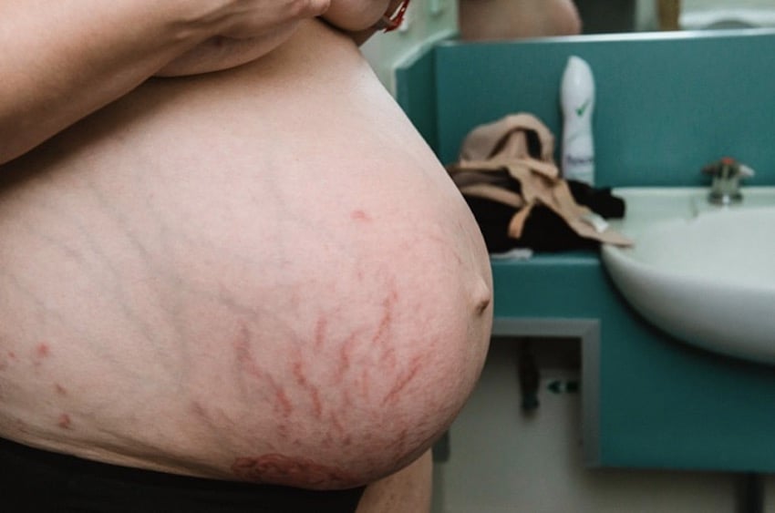 post-baby-belly-3.jpg