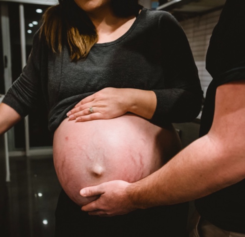 post-baby-belly-8.jpg