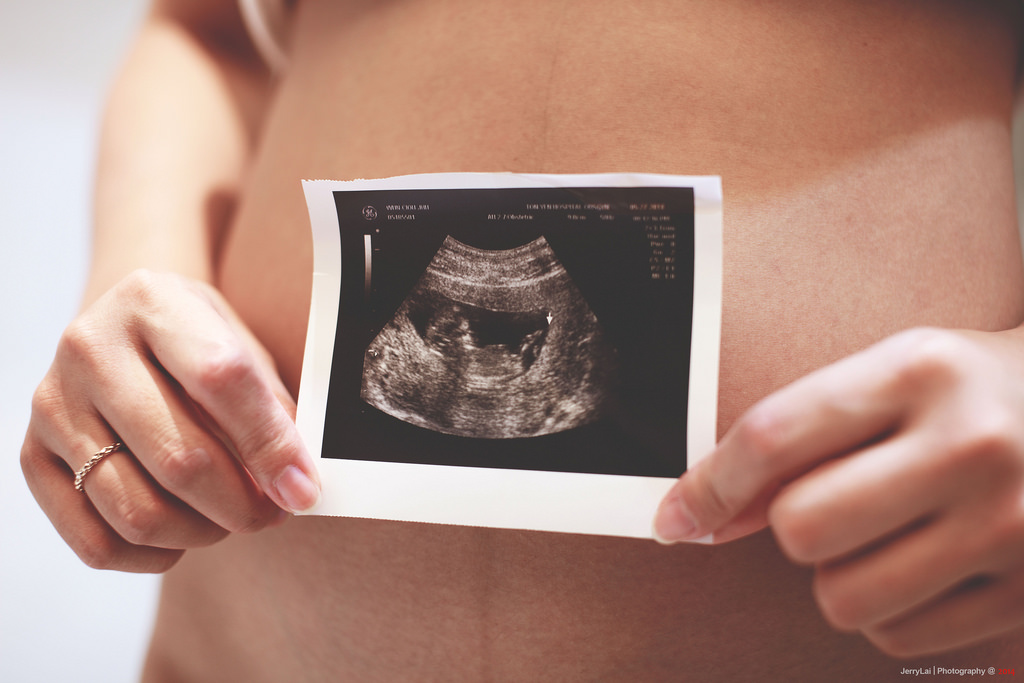 preg-4.jpg