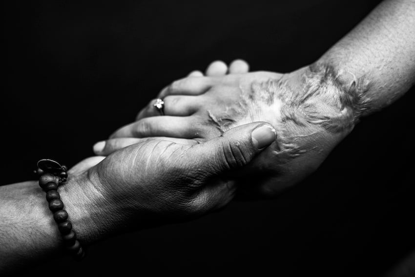 ACID ATTACK SURVIVOR FINDS LOVE