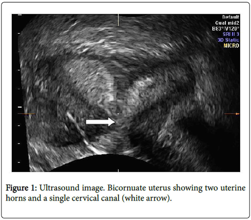 sexual-disorders-Ultrasound-image-5-172-g001.jpg